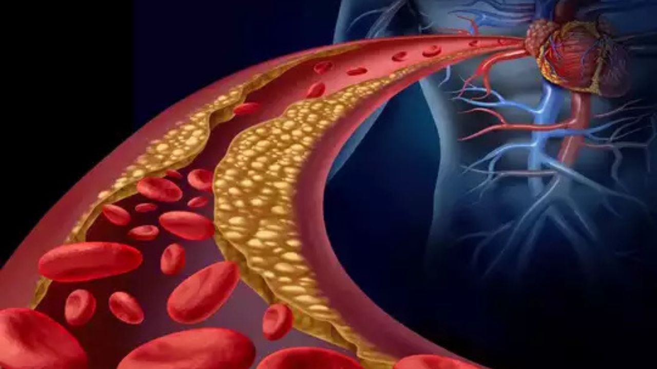 Function Of Cholesterol In Body: बढ़ता कोलेस्ट्रॉल सेहत के लिए क्यों खतरनाक, जानें इसे कम करने के उपाय