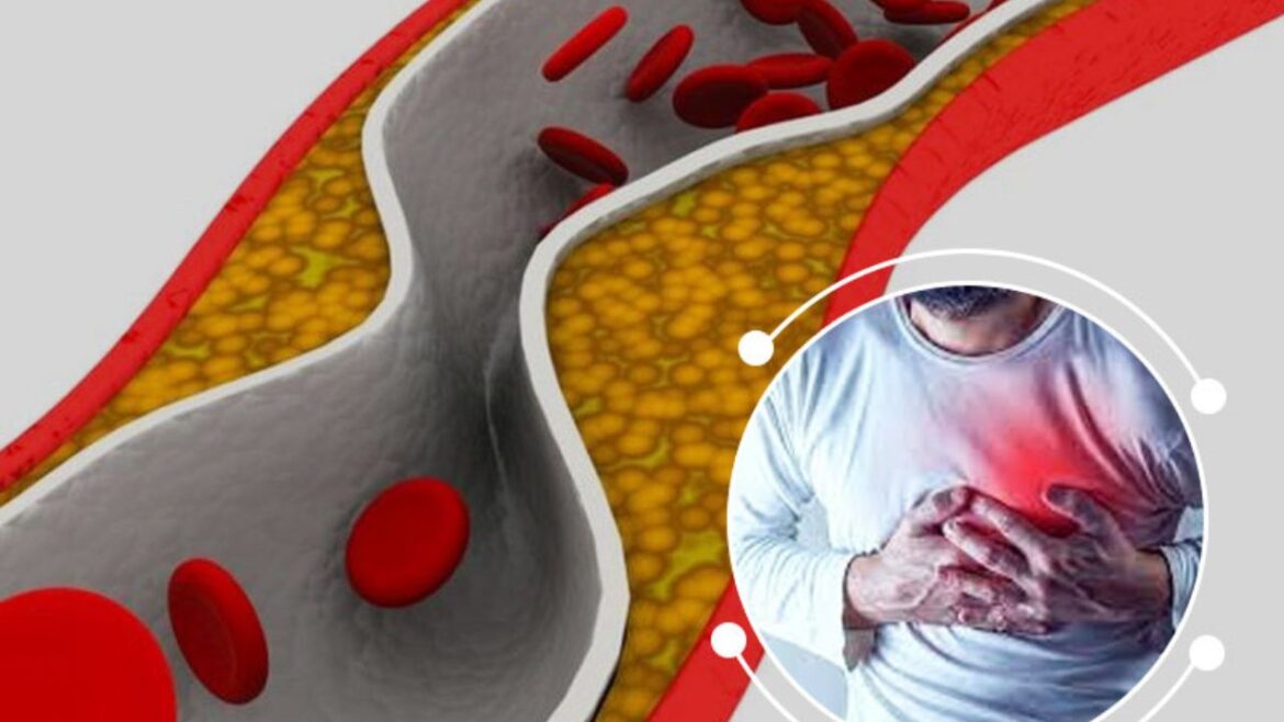 Function Of Cholesterol In Body: बढ़ता कोलेस्ट्रॉल सेहत के लिए क्यों खतरनाक, जानें इसे कम करने के उपाय