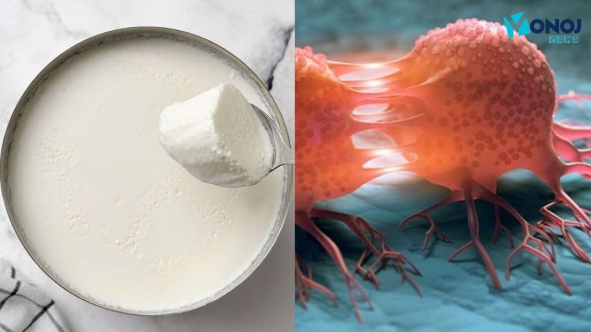 Colon Cancer Prevention: दही में छुपा है कैंसर से बचाव का राज, जानिए कैसे